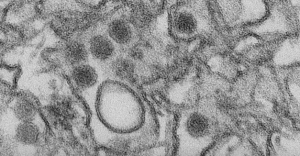 zika virus images 2