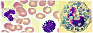 Basophils in a Blood Test images