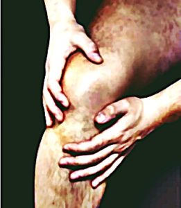 Knee Pain Location images