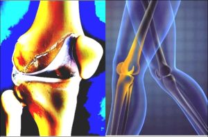 Knee Pain Location pics